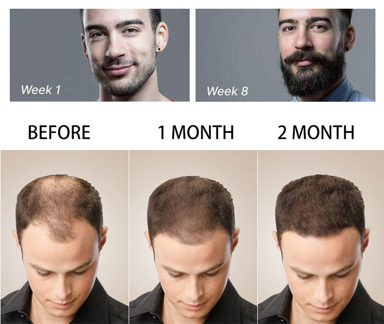 Beard maintenance kits. Variety to pick from.