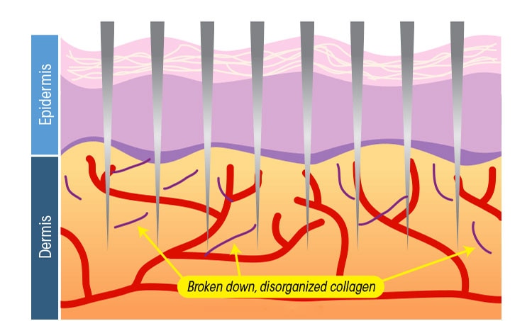 Beard maintenance kits. Variety to pick from.