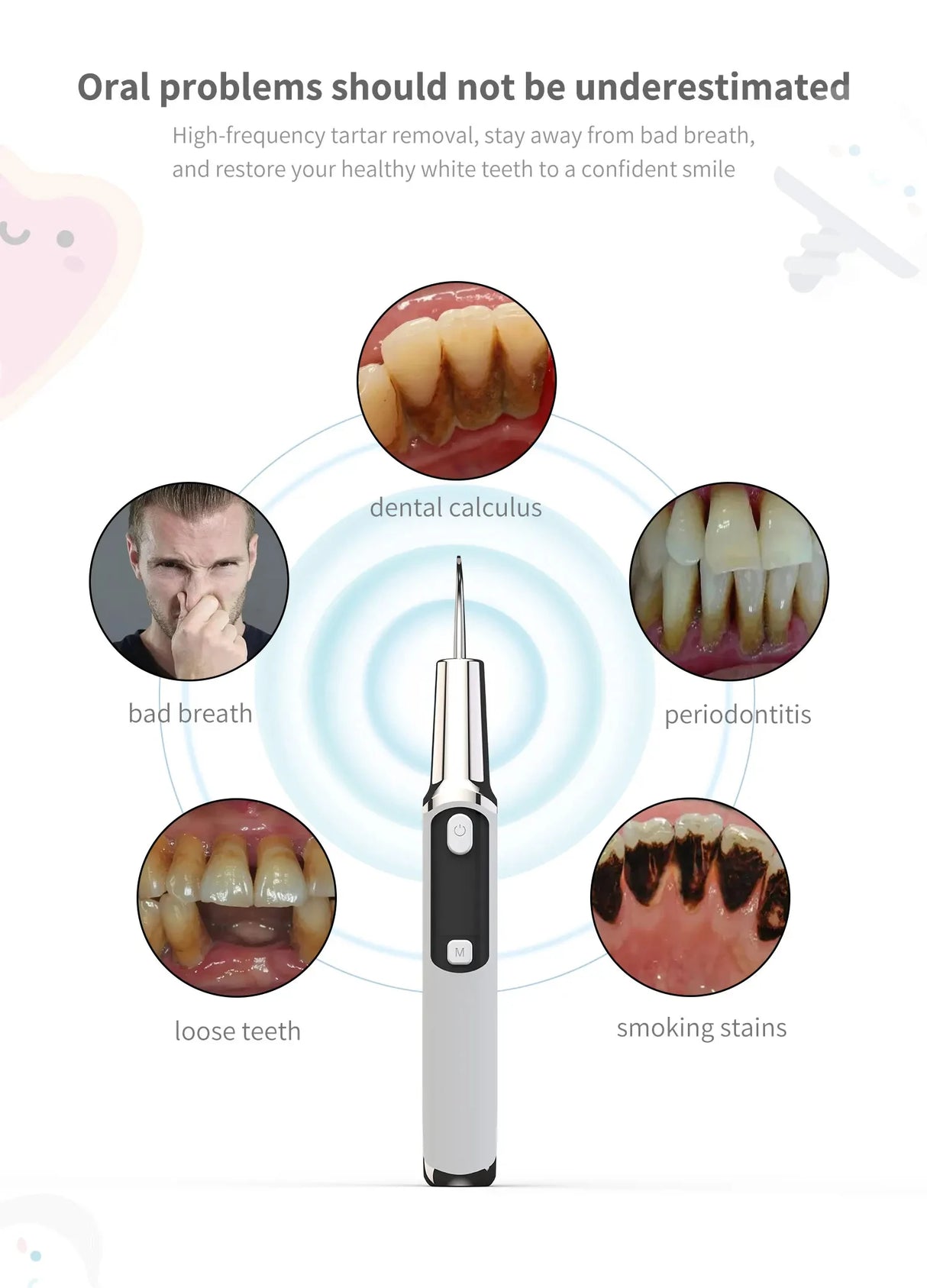 Xiaomi MIJIA Ultrasonic Dental Tartar/Stained Teeth Remover