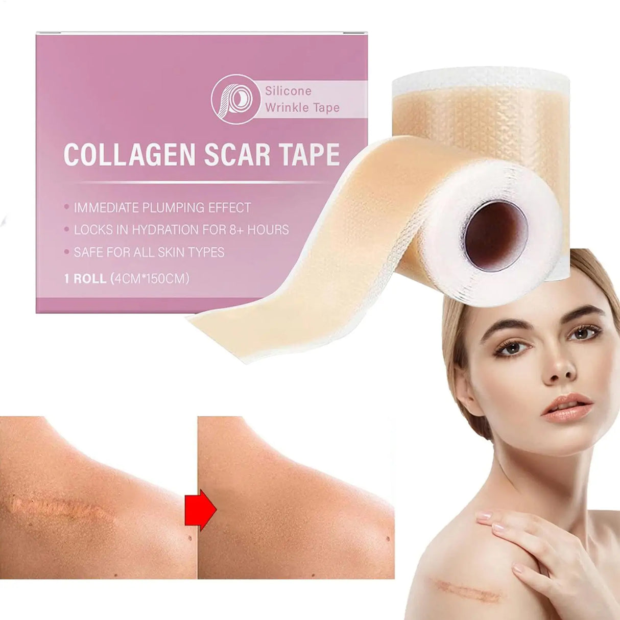 4x150cm Silicone Waterproof Self-Adhesive Scar Therapy Patch