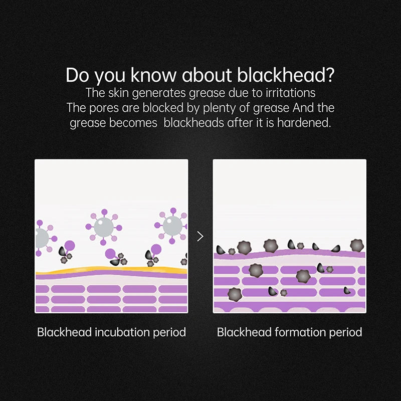 AUQUEST Facial Skin Care Mask For Removing Blackhead For a Healthier Skin l