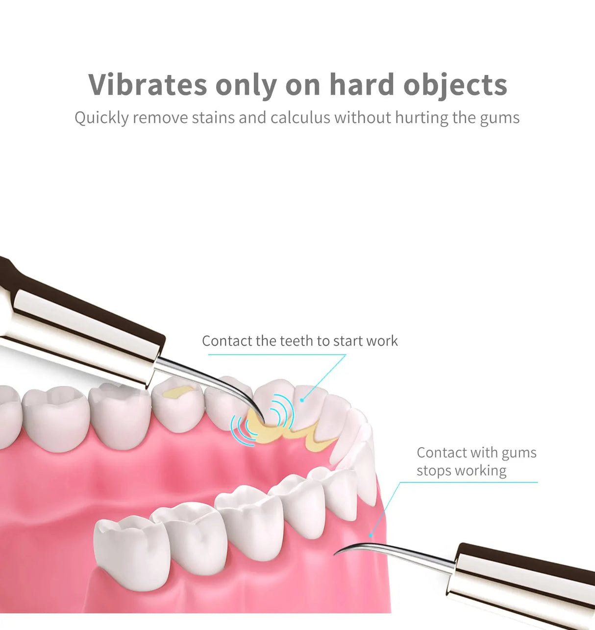 Xiaomi MIJIA Ultrasonic Dental Tartar/Stained Teeth Remover