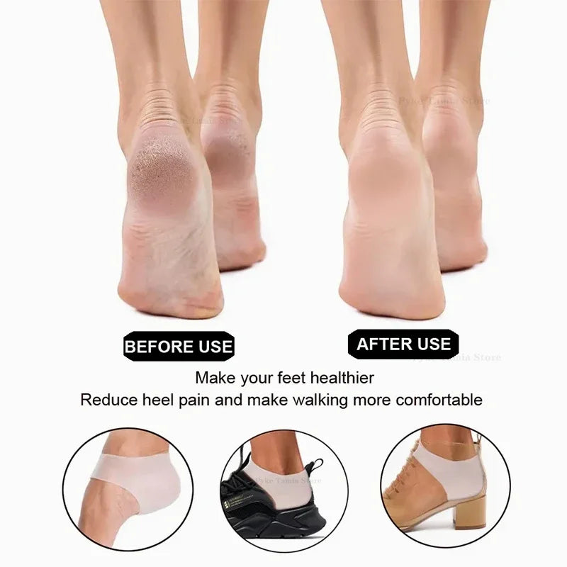 Men Or Women's Silicone Heel Protector