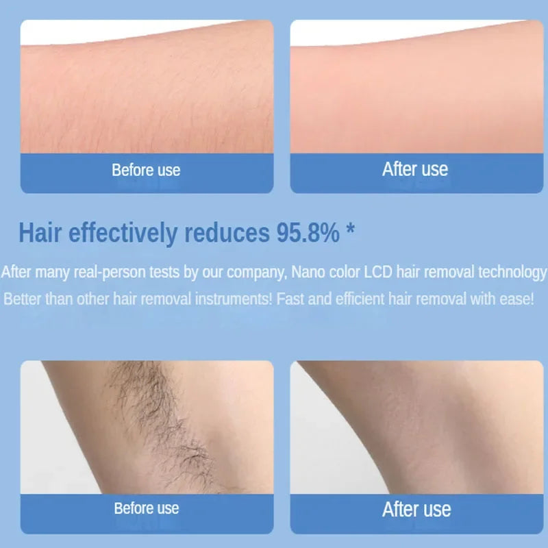 Nano Painless Epilator Hair Removal For Men Or Women