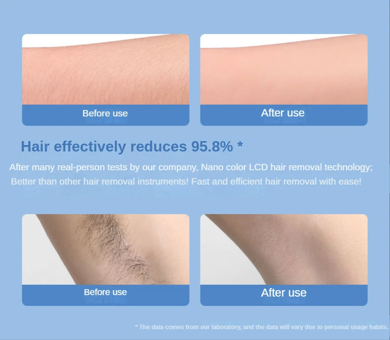 Nano Painless Epilator Hair Removal For Men Or Women