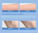 Nano Painless Epilator Hair Removal For Men Or Women