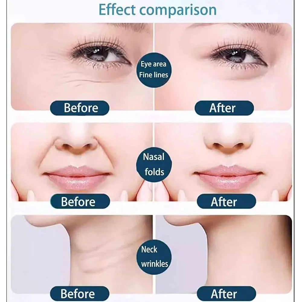Unisex Anti-Wrinkle Skin Firming Face Lift Tape