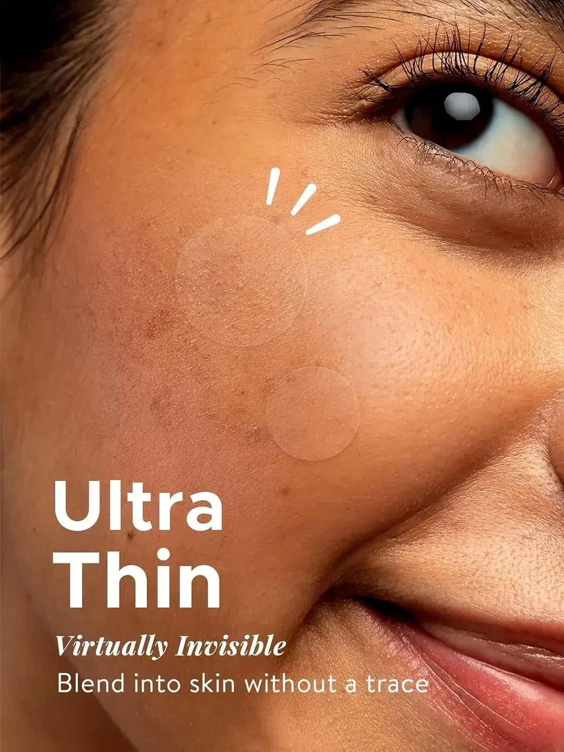360pcs Anti-inflammatory Invisible Acne Patch