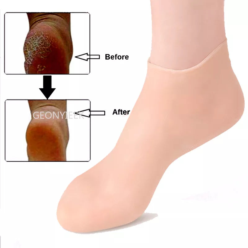 1Pair Silicone Moisturizing Skin Care Socks.