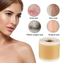 1Roll Flexible, Waterproof Silicone Strips For Reducing Surgical Scars Such As Keloid Bump