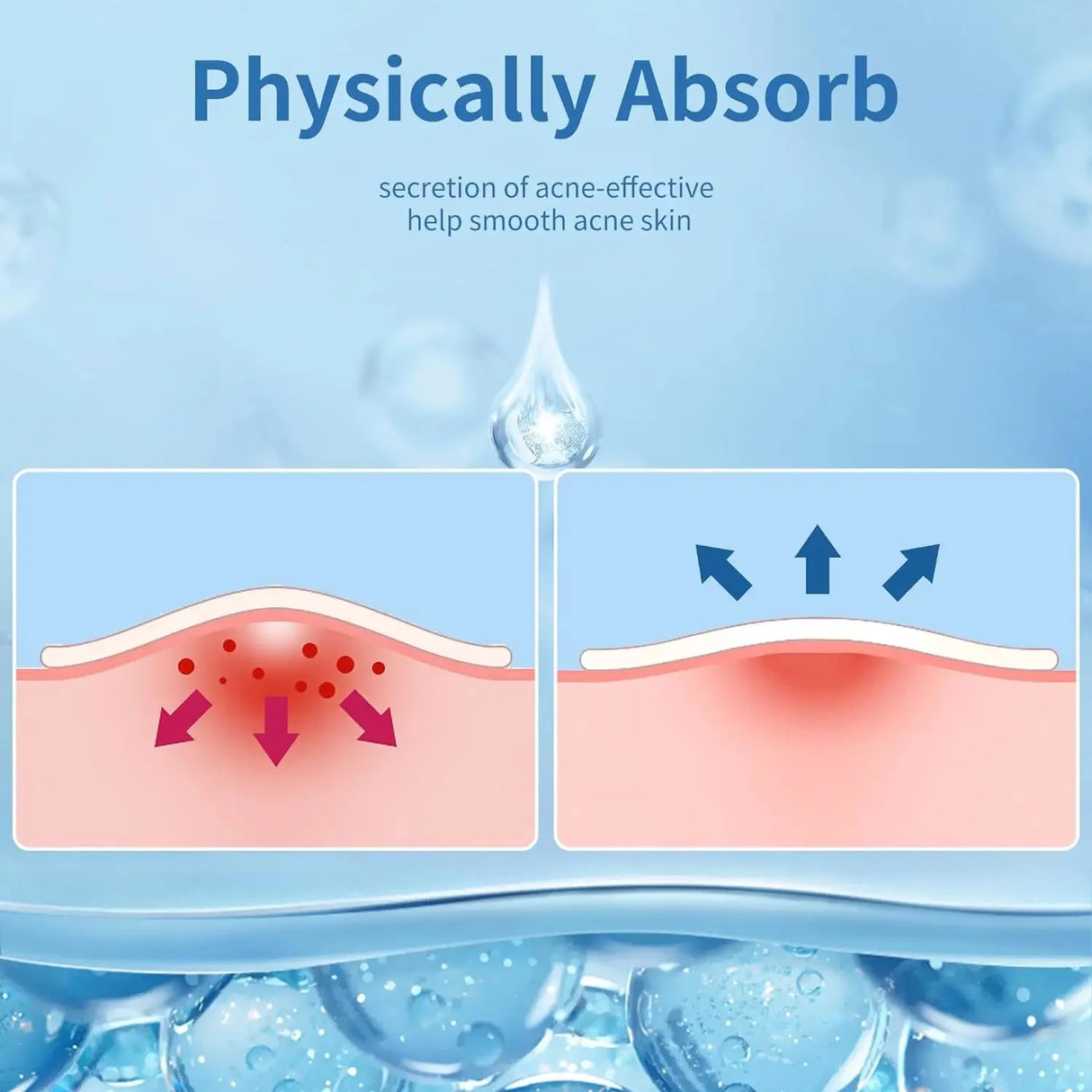 360pcs Anti-inflammatory Invisible Acne Patch