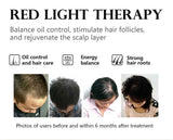 NEW 186 LED's Hat & Face Red Light Therapy For Hair Loss And Skin Rejuvenation
