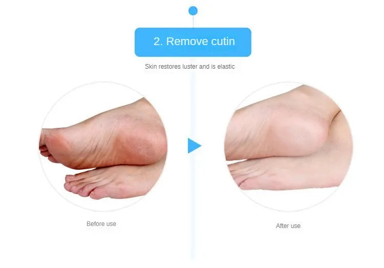 2Pcs Silicone Foot Care Moisturizing Gel Sock