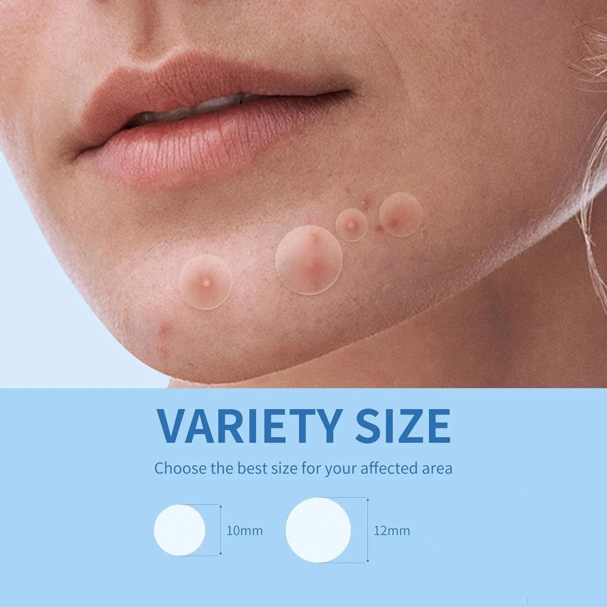 360pcs Anti-inflammatory Invisible Acne Patch