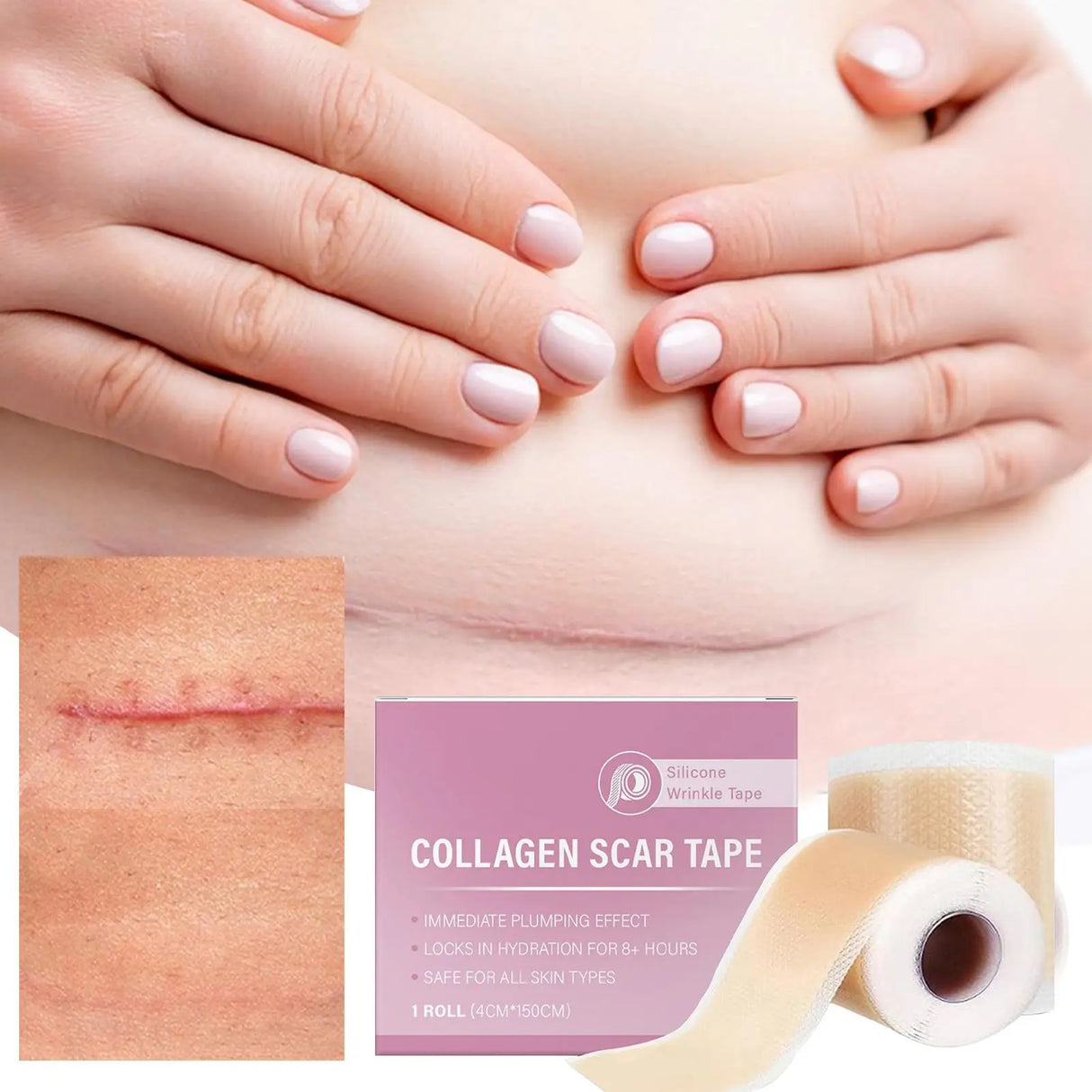 4x150cm Silicone Waterproof Self-Adhesive Scar Therapy Patch