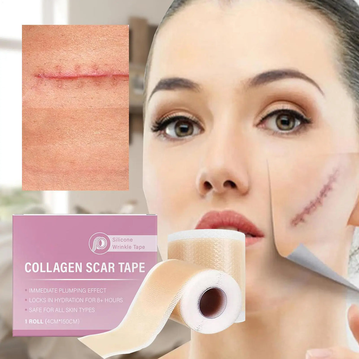 4x150cm Silicone Waterproof Self-Adhesive Scar Therapy Patch