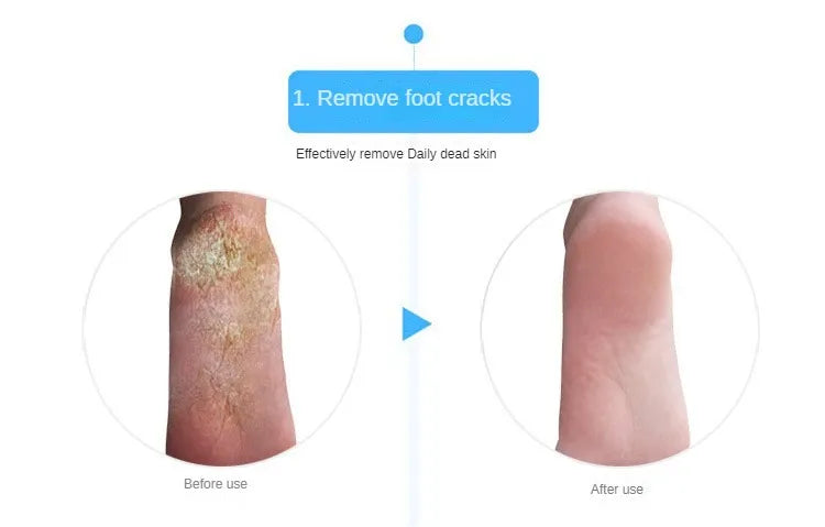 2Pcs Silicone Foot Care Moisturizing Gel Sock