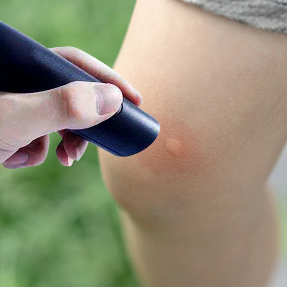 Electronic Anti-itch Relief Burning Pain & Swelling Pen