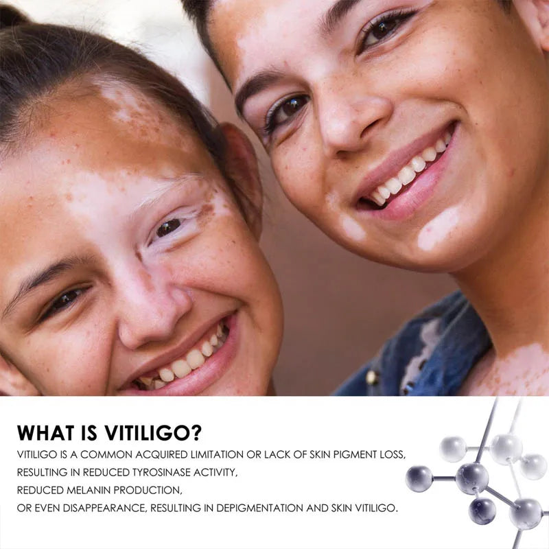 311NM UVB Phototherapy For Vitiligo Or Psoriasis Treatment At Home